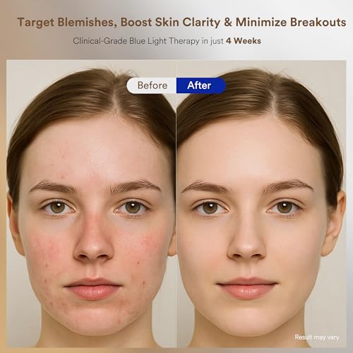 4 Color LED Face Mask Light Therapy, Red Light Therapy for Face, FDA Cleared with 324 Medical Grade Chips, 3 Modes for Anti Wrinkle & Acne, At-Home Skin Tightening Device, Luxury Beauty Gift - Image 8