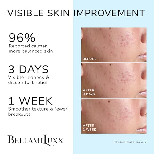 Image of BellamiLuxx Cystic Acne Treatment for Face: Hormonal Acne Treatment Cream for Teens & Adults - Salicylic Acid & Tea Tree Oil Pimple Spot Remover - Anti-Acne Moisturizer Reduces Redness, Blemishes