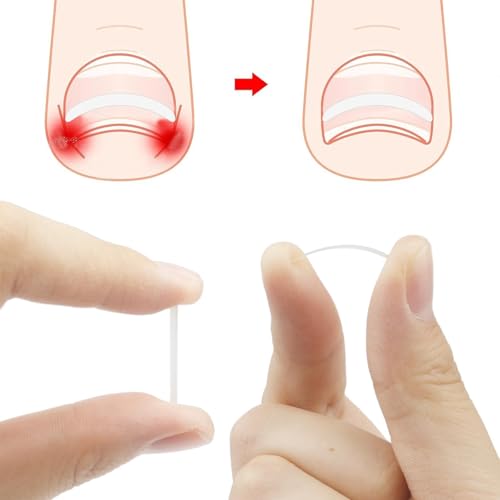 Kit de ferramentas de unhas encravadas com lixa de unha encravada e levantadores com 30 tiras de unh