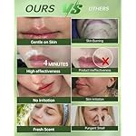 Painless Facial Hair Removal Cream for Women - Sensitive Skin 2-in-1 Kit with Soothing Cream | Upper Lip & Chin Hair Remover | At-Home Depilatory (4 Min, 7 Days Smooth),2.03 Fl Oz - Image 4