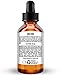 TruSkin Vitamin C Serum for Face, Anti Aging Serum with Hyaluronic Acid, Vitamin E, Organic Aloe Vera and Jojoba Oil, Hydrating & Brightening Serum for Dark Spots, Fine Lines and Wrinkles, 1 fl oz
