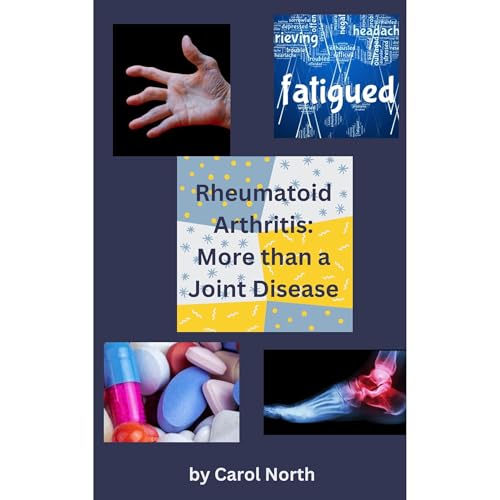 Rheumatoid Arthritis: More than a Joint Disease by Carol North episode artwork