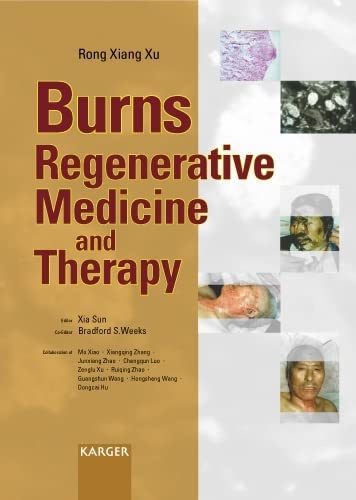 Buy Burns Regenerative Medicine and Therapy — BookShops.in
