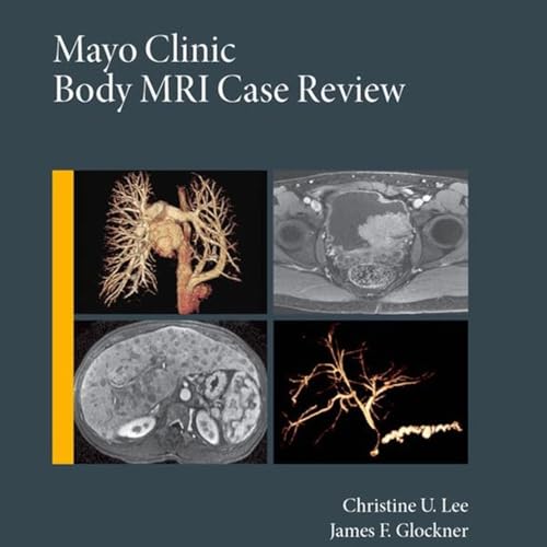 Mayo Clinic Body MRI Case Review