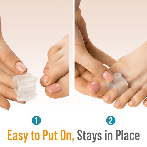 Toe Spacers for Men and Women – 4 Gel Toe Separators, Hammer Toe Straightener, Correct Toes, by 5 Stars United