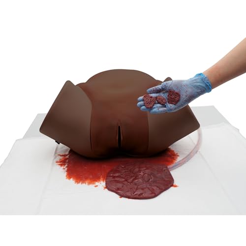 3B Scientific® Postpartale Hämorrhagie (PPH) Simulator – Dunkle Haut, Geburtstrainer für Uterusblutung, Gerinnselentfernung & Kompressionsübungen