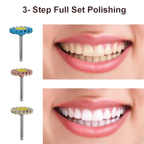 Image of Dental Composite Resin Polishing P3 Disc Polisher Wheels Diamond 3-Step Diamond Impregnated Polishing System System 14mm Wheel Kit Spiral Flex Brush Tools