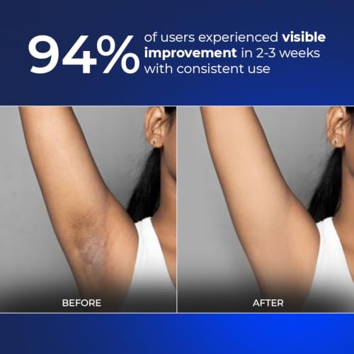 Image of Aqueria Underarm Brightening Roll On for Men & Women | Lactic Acid, Glycerine, Fermented Rice Water & Propanediol | Helps Reduce Dark Underarms, Pigmentation & Discoloration | Exfoliating Deodorant Roll On | Pack of 3 (150ml)
