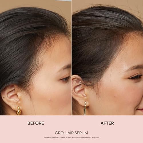 VEGAMOUR GRO Hair Serum – Plant-Based Scalp Tonic for Fuller-Looking Hair, 3.4oz — view 3