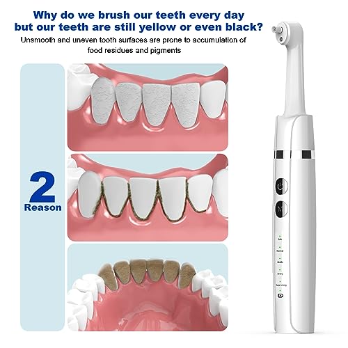 Beiermu WD-JY-B01 Tooth Polisher,Teeth Polishing Kit For Daily Cleaning,Polishing Then Whitening Of Tooth (Professional Toothpaste Include),Usb Rechargeable Dental Polisher thumb #2