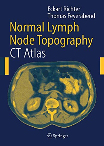 Normal Lymph Node Topography: Ct-Atlas view 2