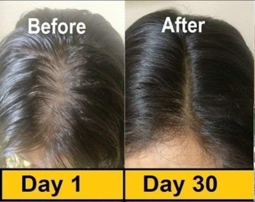 50 Evion Capsules Vitamin E For Glowing Face,Strong Hair,Acne,Nails, Glowing Skin 400Mg #TOP3