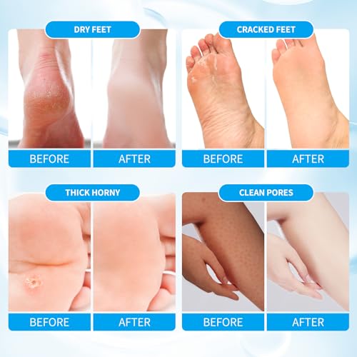 image for nbc BeautiLab Pedicure Kit Foot Soak Set: Bubble Salt, Sugar Scrub, Ma