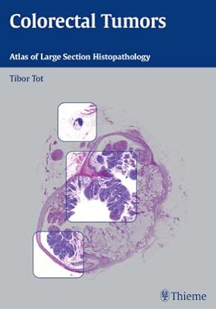 Colorectal Tumors: Atlas of Large Section Histopathology book cover