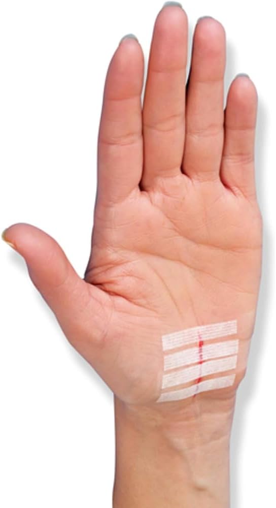 Nexcare Steri-Strip Skin Closure Strips 1/4 Inch X 4 Inches 30 Each (Pack of 2)