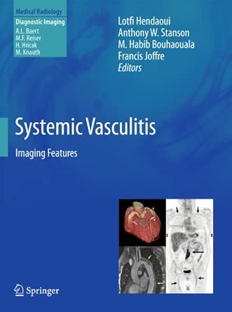 Systemic Vasculitis: Imaging Features 2012th Edition Systemic Vasculitis: Imaging Features 2012th Edition book cover