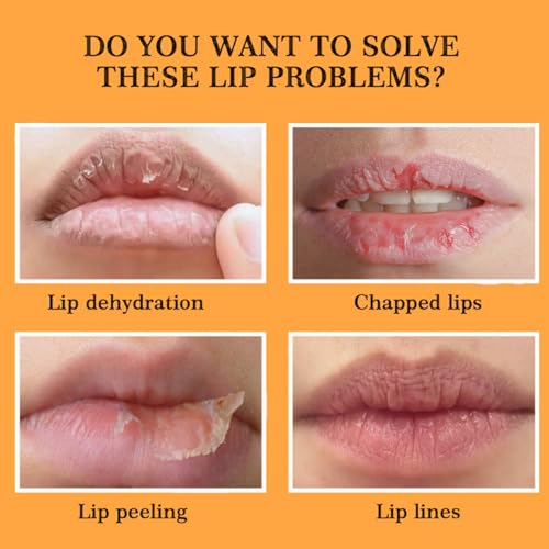 Ginger Lip Lightening for Dark Lips,Lips Pink Bleaching Cream Balm,Lip Balm,Fast Moisturizing Lightening Lip Balm,Brightening Cream Blam,Lip Care Lightens Remove Dark Lips,Lip Pigmentation Treatment - Image 5