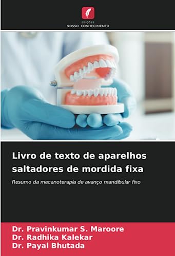 Livro de texto de aparelhos saltadores de mordida fixa: Resumo da mecanoterapia de avanço mandibular fixo