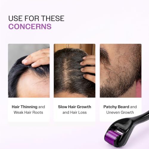 Image of Bare Anatomy Derma Roller for Hair Growth | 0.5 mm with 540 Titanium Micro Needles | Stimulates Hair Follicles & Improves Scalp Circulation
