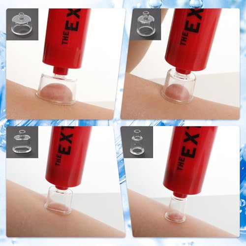 Gvhntk Kit de picadas de cobra, extrator de veneno, bomba de sucção, kit de mordida de emergência, s