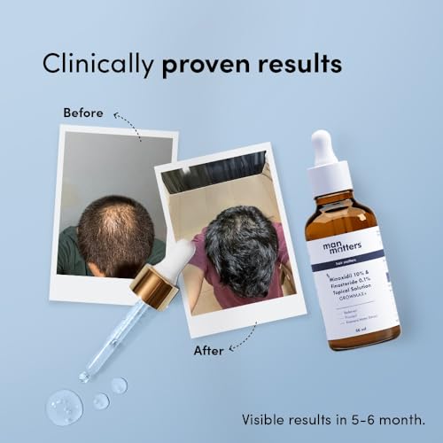 Image of Man Matters GrowMax+ Minoxidil 10% with 0.1% Finasteride Solution Serum I Prevent Hair Loss, Thinning I Revitalise Hair and Beard Regrowth I Alcohol Free, Non-Sticky, Unscented I Extra Strength | 50ml