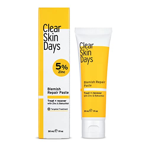 Clear Skin Days Blemish Treatment Cream - Overnight Spot & Acne Treatment for Face - with Salicylic Acid & Zinc - Calm Aggravated Skin, Treat Blemishes & Acne 30ml