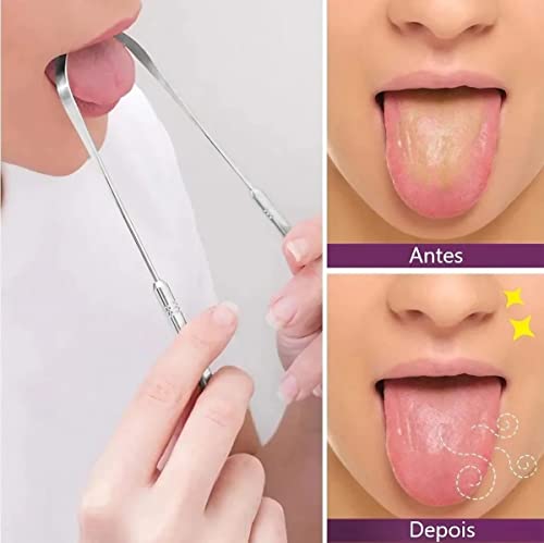 Raspador De Língua Limpador Higienizador de Língua em Aço Inoxidável | Melhora a Higiene Oral e a Di