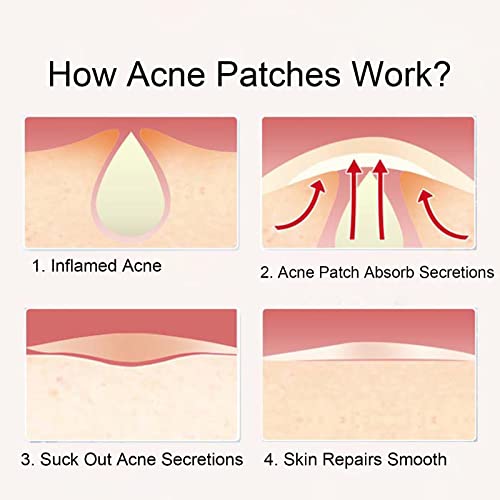 Lamkrtlp Cerotti Brufoli, Impermeabili e