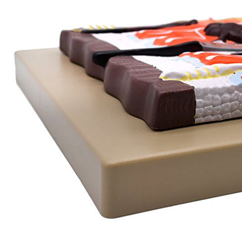Image of EISCO Human Skin Model, 300x Enlarged - with Hand Painted Details - Mounted on Base, 13 inch x 10 inch