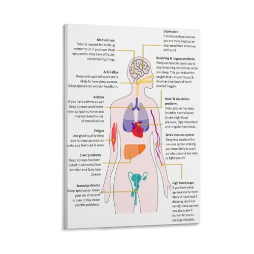Signs And Symptoms of Sleep Apnea Poster Medical Knowledge 2