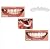 5 Sets Cosmetic Venners Dentures Teeth Veneers Fake Braces Snap on Your Smile Veneer Instant Perfect Smile Essential for Dating and Work 5 Upper and 5 Lower