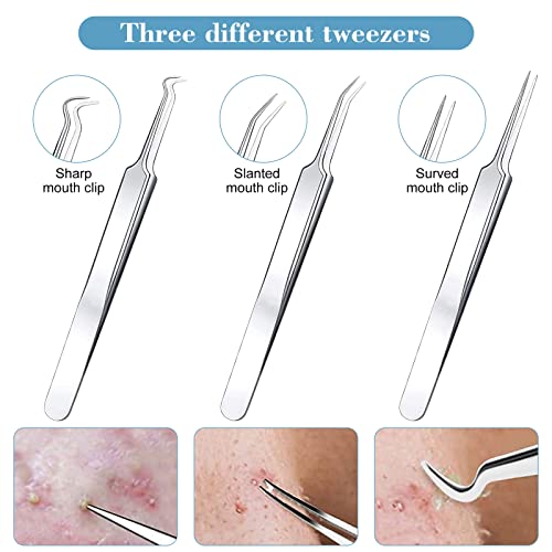 13 Stück Pickelentferner Werkzeuge Mitesserentferner Set,Komedonenquetscher Warzenentferner Akne Pickel Mitesser… - Image 4