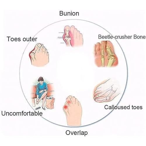 Men's Orthopedic Sandals PU Leather Sandals Summer Fashion Luxury Flip Flops Casual Slippers Flat Beach Shoes for Adult Indoor Outdoor Comfort3