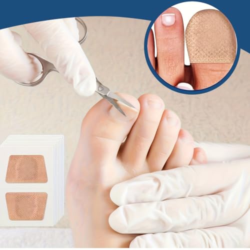 OYZOQ 32 Stück Zehennagel-Korrekturpflaster, fungal nail patches zur Verbesserung des Aussehens verfärbter Nägel