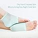 Bememo Soft Gel Heel Socks Ventilate Open Toe Socks 4 Pairs for Dry Hard Cracked Skin Moisturizing Day Night Care Skin (Pink, Turquoise, Grey and Black)