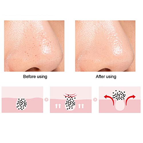 Silikon-Nasenreinigungsbürste, Silikon-Peeling-Lippenbürste, Tiefenreinigungs-Peeling-Lippenbürste mit Doppelseitiger Oberfläche, Gesichtsbürste Zur Reinigung von Mitessern,(Rosa)