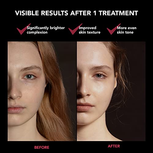 FAQ 201 RGB LED Face Light Therapy Mask - Anti Aging & Wrinkle Red Light Therapy - Face Masks Skin care - Wireless Face Masks Beauty - LED Face Mask - 600 Light Points - Wearable Skin Care Device - Image 5