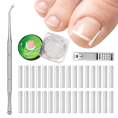 Set zur Korrektur eingewachsener Zehennägel, 62 Stück Schmerzfreie Zehennagelglättungsstreifen mit Zehennagelheber und Nagelklipper, einfaches Werkzeugse