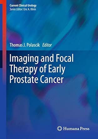 Imaging and Focal Therapy of Early Prostate Cancer 2013th Edition book cover