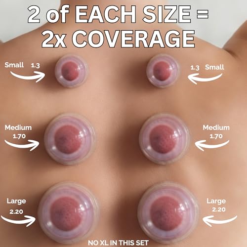 Image of Cupping Warehouse Supreme 6 Intermediate Pro 5560 Silicone Cupping Set - 6 Cup Massage Therapy Kit for Beginners - Medical-Grade, Soft Cups for Pain Relief, Cellulite Reduction & Body Sculpting