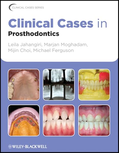 Clinical Cases in Prosthodontics (Clinical Cases (Dentistry)) Clinical Cases in Prosthodontics (Clinical Cases (Dentistry))