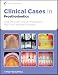 Clinical Cases in Prosthodontics