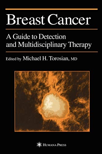 Breast Cancer: A Guide to Detection and Multidisciplinary Therapy ...