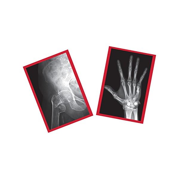 Roylco-R-59255-Fixed-Bones-X-Rays-BlackWhite-14-Pieces-ModelR59255 Roylco-R-59255-Fixed-Bones-X-Rays-BlackWhite-14-Pieces-ModelR59255