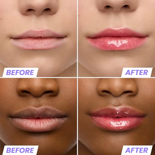Image of Wonderskin Lip Oil - Tinted Lip Oil, Hydrating Lip Serum
