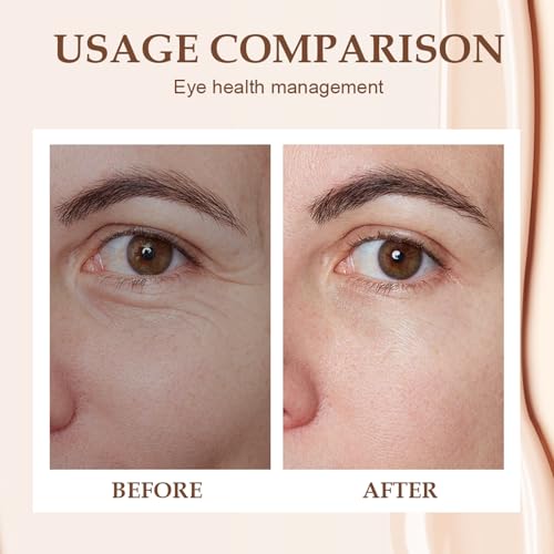 Foxiod Eye Balm, 2025 Upgrade Revive and Glow Vitamin C Eye Balm, Brightening and Reducing Dark Circle, Portable Hydrating Cream, Reduces Puffiness, Eyes Care Stick for Women (1)