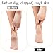 5 Pairs Spa White Cotton Socks Moisturizing Socks Overnight Reusable Lotion Sock Absorbing Soft Moisture Foot Heel Sleeping Sock for Women Men Dry Cracked Feet Beauty Pedicure
