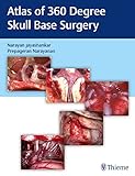  Atlas of 360 Degree Skull Base Surgery