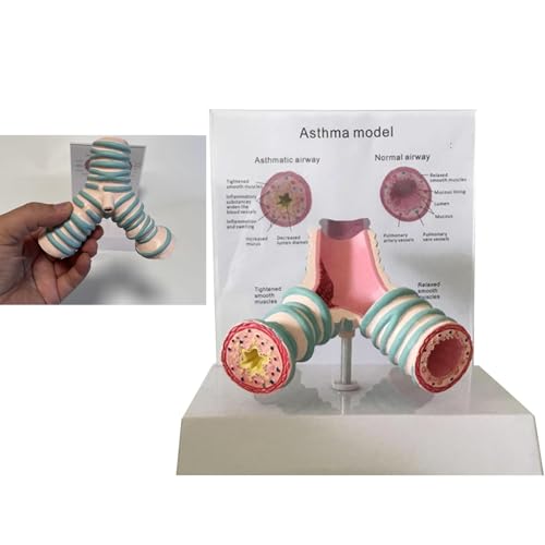 TQPGJJL Modelo anatómico de asma con Etiquetas bilingües - Exhibición 3D del Sistema respiratorio for colección científica, decoración de consultorios médicos y Regalo Educativo (18 x 15 x 21 cm)