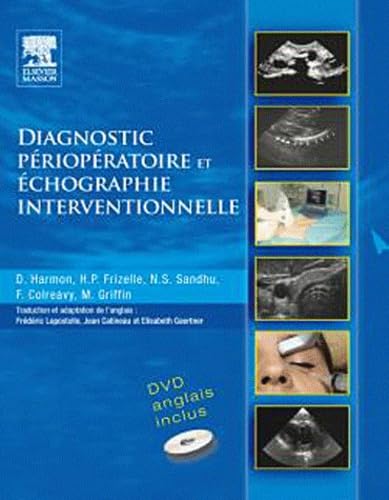 livre Diagnostic périopératoire et écographie interventionnelle (avec DVD)